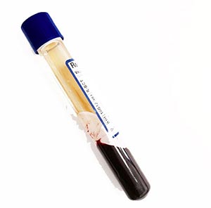TUBE DE PLASMA RICHE EN PLAQUETTES